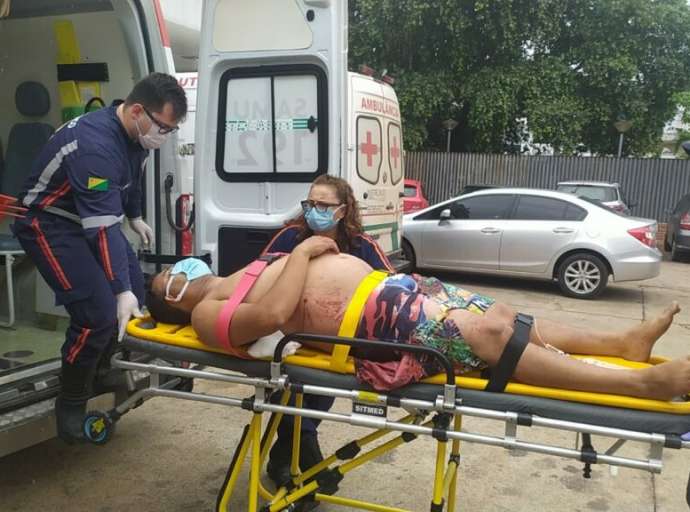 Homem é ferido com dois tiros após ter casa invadida na Baixada da Sobral